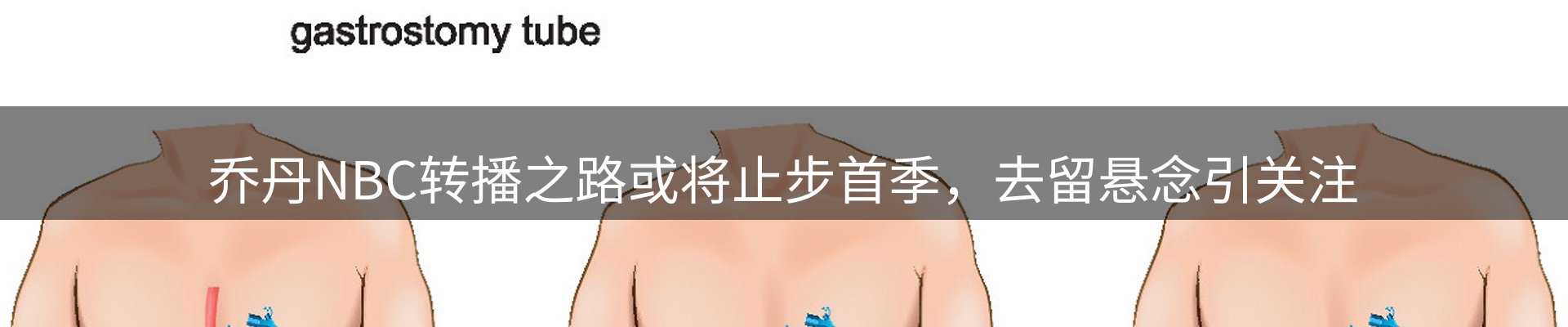 焦点速递
